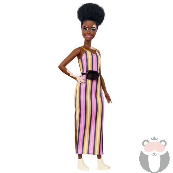 Кукла Mattel Barbie Fashionistas витилиго